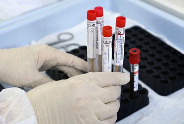 image-1617169384_analput700