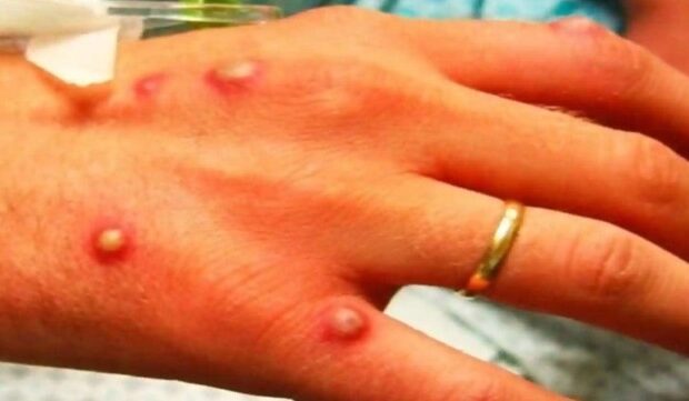 image-1652941222_5de3419c-b55f-42f8-b59c-c4ff5448d736