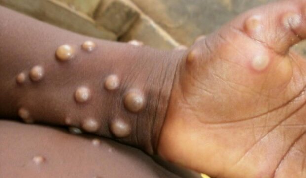 image-1654260679_16532945031713352127_1200x630