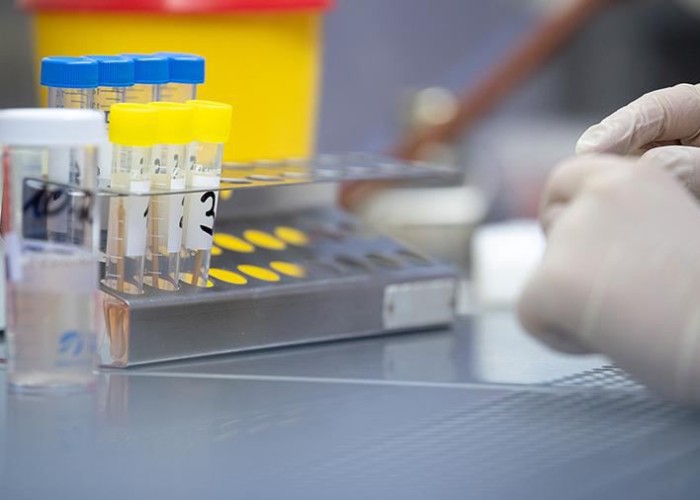 image-1654288518-coronavirus_laboratory_260320