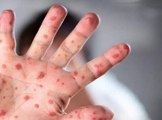 image-1655283202-aztibb-az_resized_daec3-7080f9d5pic_374