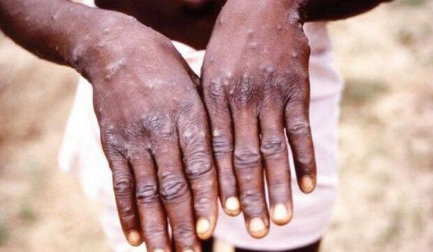 image-1655530470_16535209631119421884_1000x669