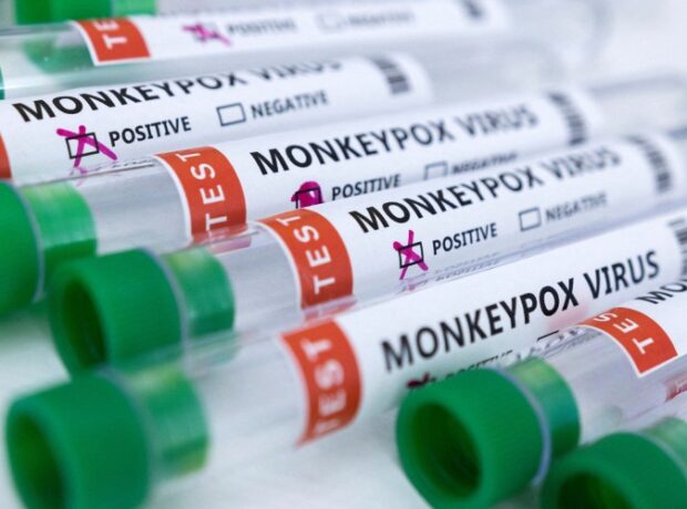 image-1658909818-yjspcivj4bjozghhtftmupzkaq