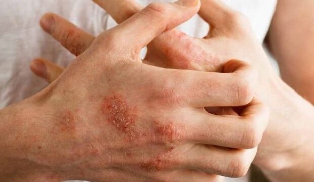 image-1660544721_624eb817b2c06624eb817b2c071649326103624eb817b2c04624eb817b2c05